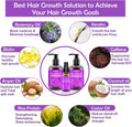 Hair Growth Shampoo and Conditioner Set with Rosemary Oil Serum,  Hair Loss Treatment, Thickening for Women and Men
