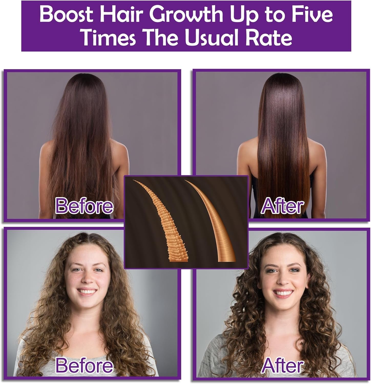 Hair Growth Shampoo and Conditioner Set with Rosemary Oil Serum,  Hair Loss Treatment, Thickening for Women and Men